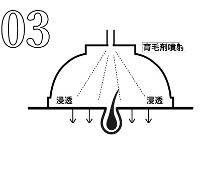 真空含浸装置の施術工程3