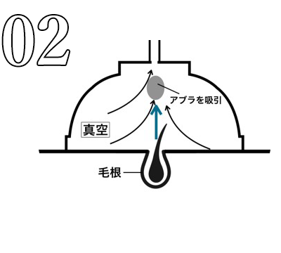 真空含浸装置の施術工程2